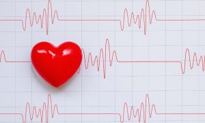 a series of cardiogram beats on a chart with a heart on the left